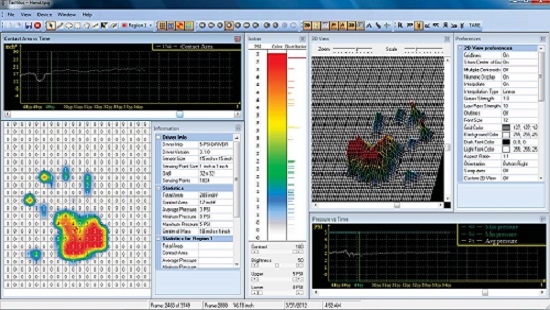 压力分布仪器足弓检测的应用